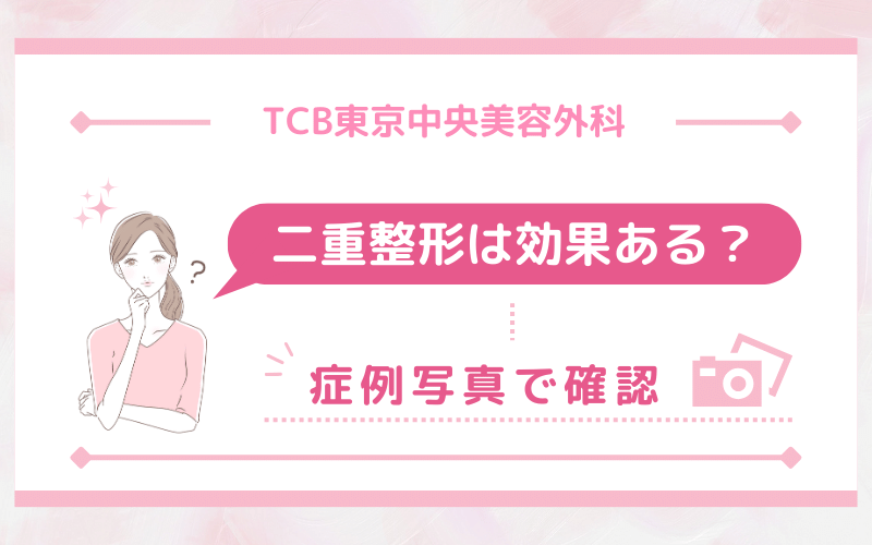 TCB東京中央美容外科 二重整形は効果ある？症例写真で確認！