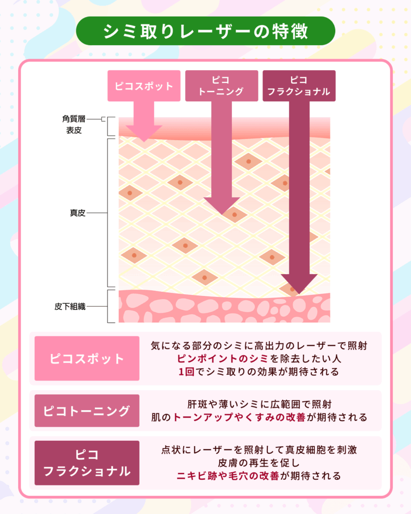 新潟のシミ取りレーザー種類